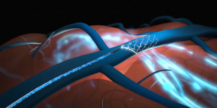 U.S. regulators rejected Elon Musk’s bid to test brain chips in humans