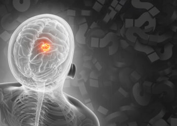 AI model can help determine where a patient’s cancer arose