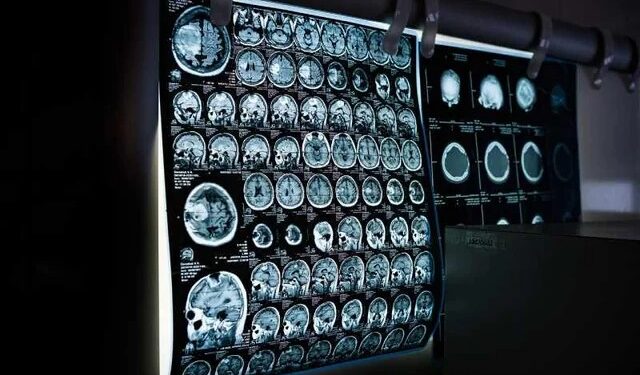 New AI tool promises breakthrough in clinical research
